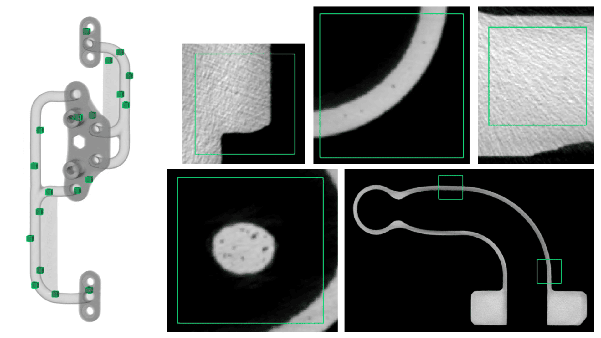 A metal orthopedic implant is shown on the left with green squares marking points of interest. On the right, five black-and-white close-up images highlight detailed views of the implant’s surface and structure.