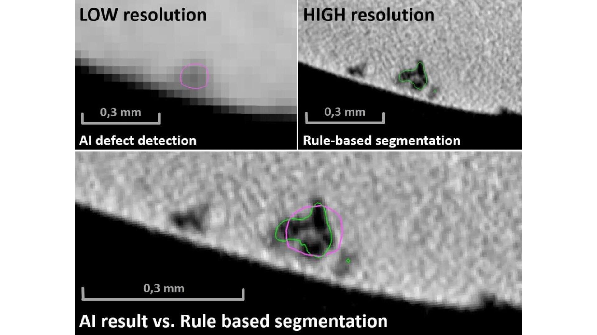 Comparison of low and high resolution images showing AI defect detection (purple outline) and rule-based segmentation (green outline) of a material surface, highlighting differences in defect identification. Scale bar: 0.3 mm.