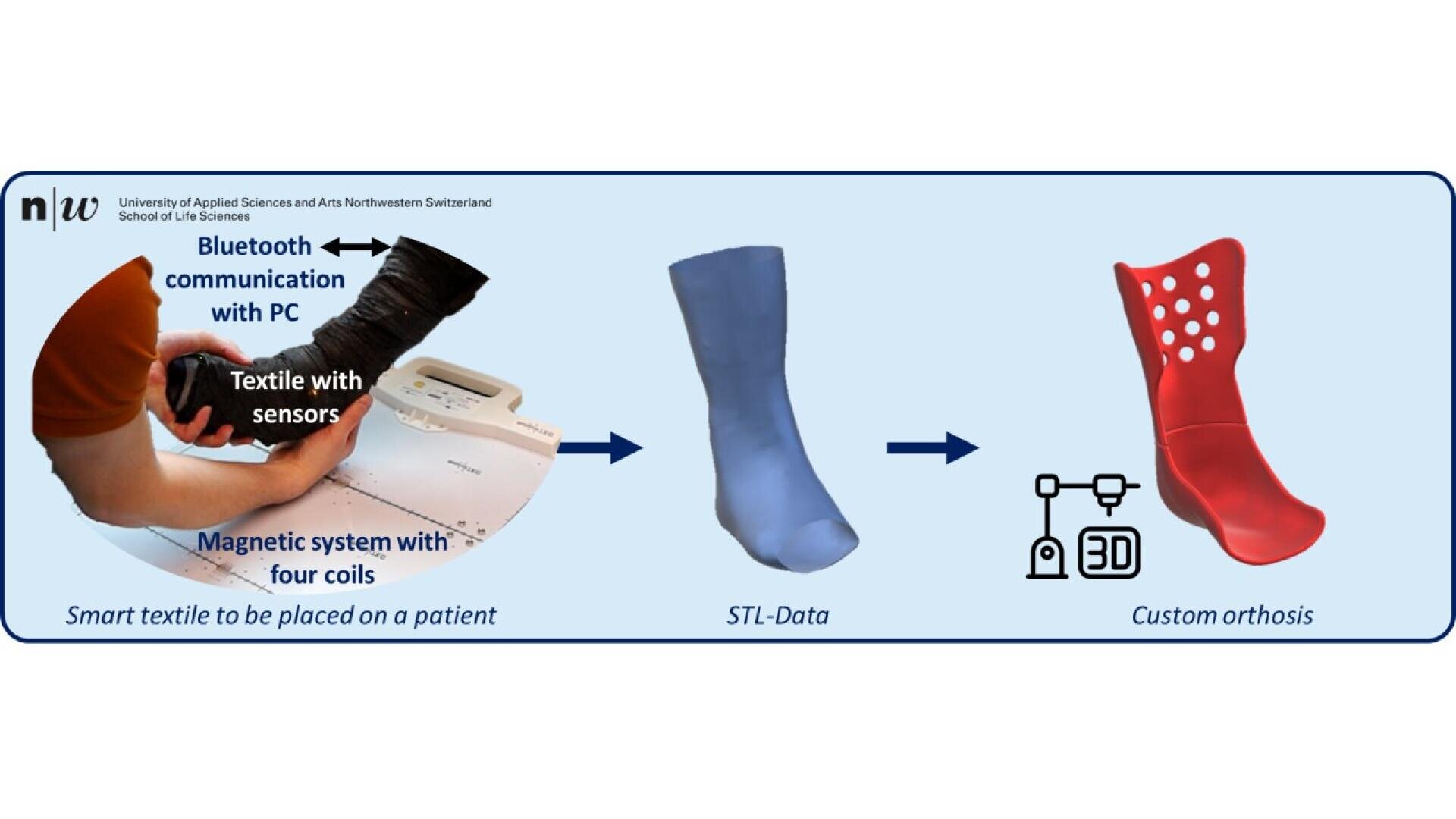 A process flowchart showing: a smart textile with sensors placed on a patient’s leg, transmitting data via Bluetooth to a PC; STL-Data of the leg; and custom orthosis produced with 3D printing.