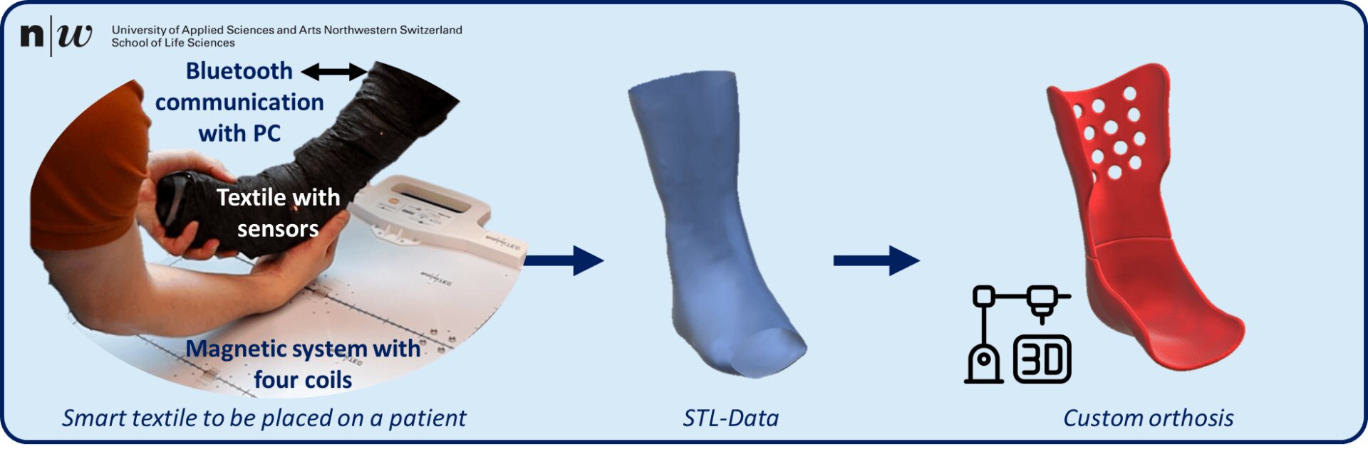 Ein Diagramm, das ein intelligentes Textil mit Sensoren und Bluetooth, ein 3D-STL-Modell und eine kundenspezifische rote Orthese zeigt und den Prozess vom Scannen des Textils bis zur Herstellung der kundenspezifischen Orthese per 3D-Druck veranschaulicht.