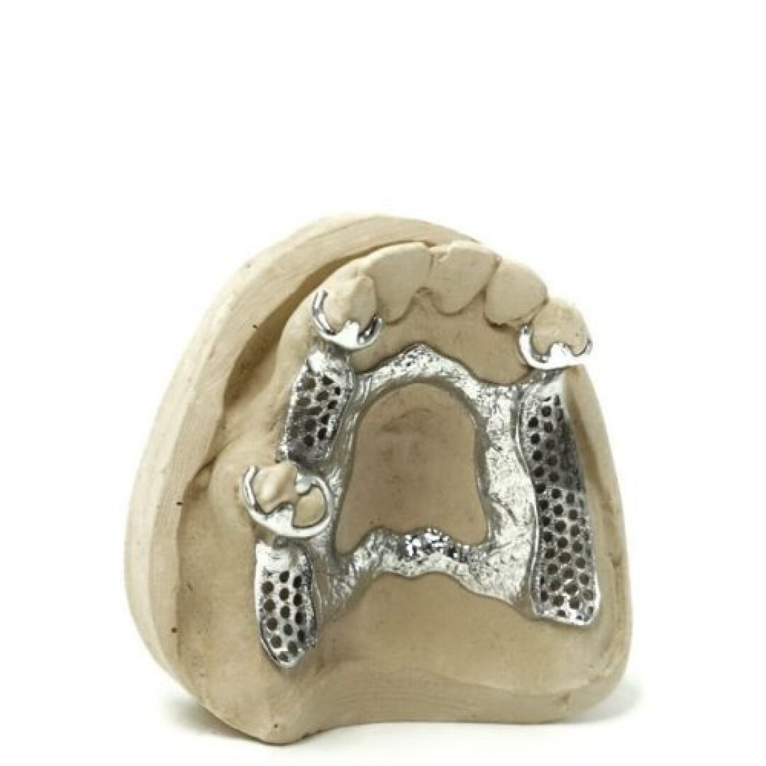 Ein Zahnabdruckmodell, das ein auf künstliche Oberzähne und Zahnfleisch aufgesetztes Metallgerüst einer Teilprothese zeigt und für Zahnprothesen oder -restaurationen verwendet wird.
