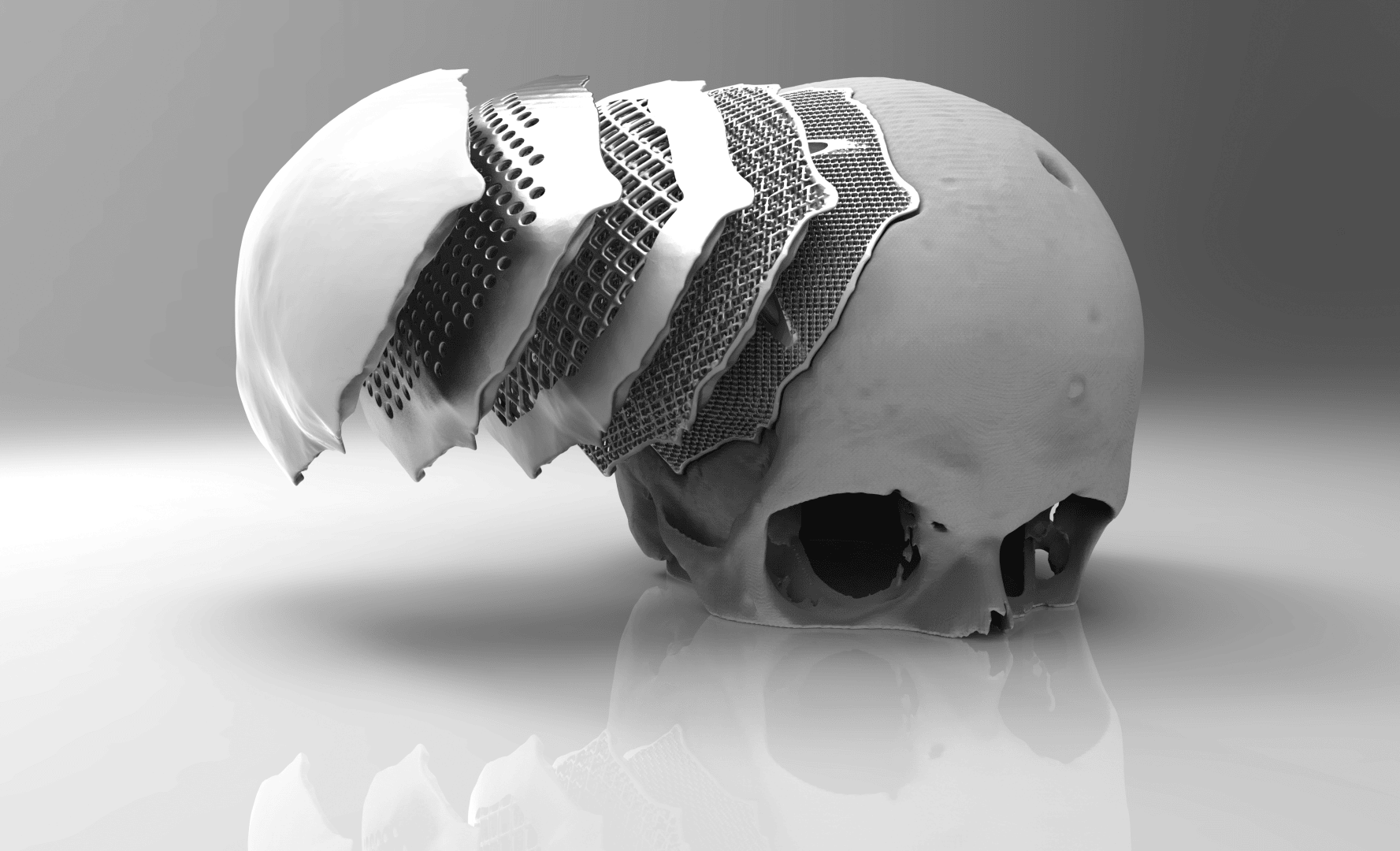 A human skull with the left side sliced into sections, revealing layers with intricate, mesh-like patterns resembling 3D-printed material, set against a smooth, gradient background.